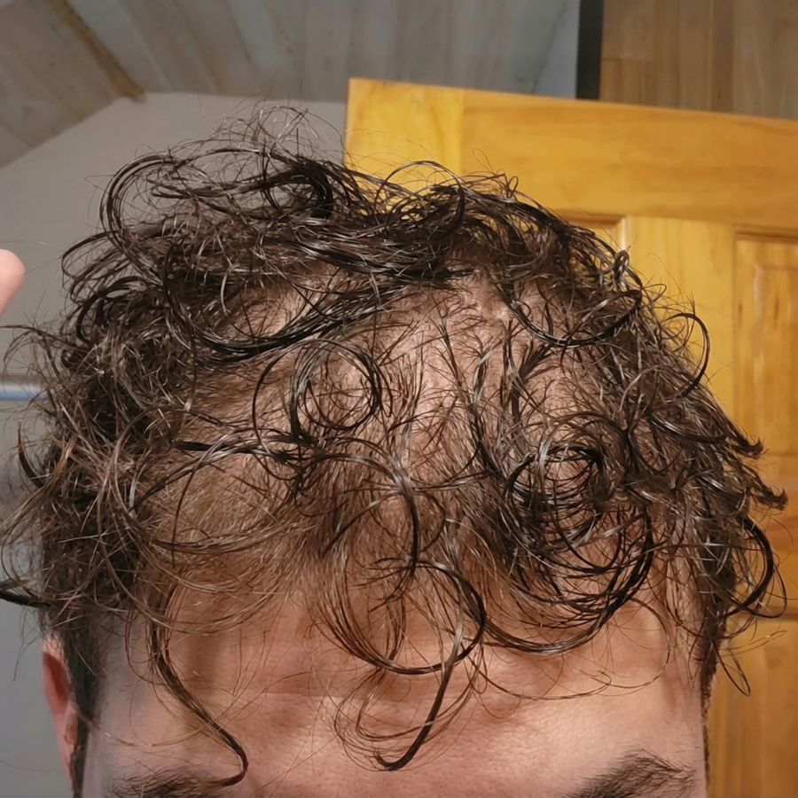 Before