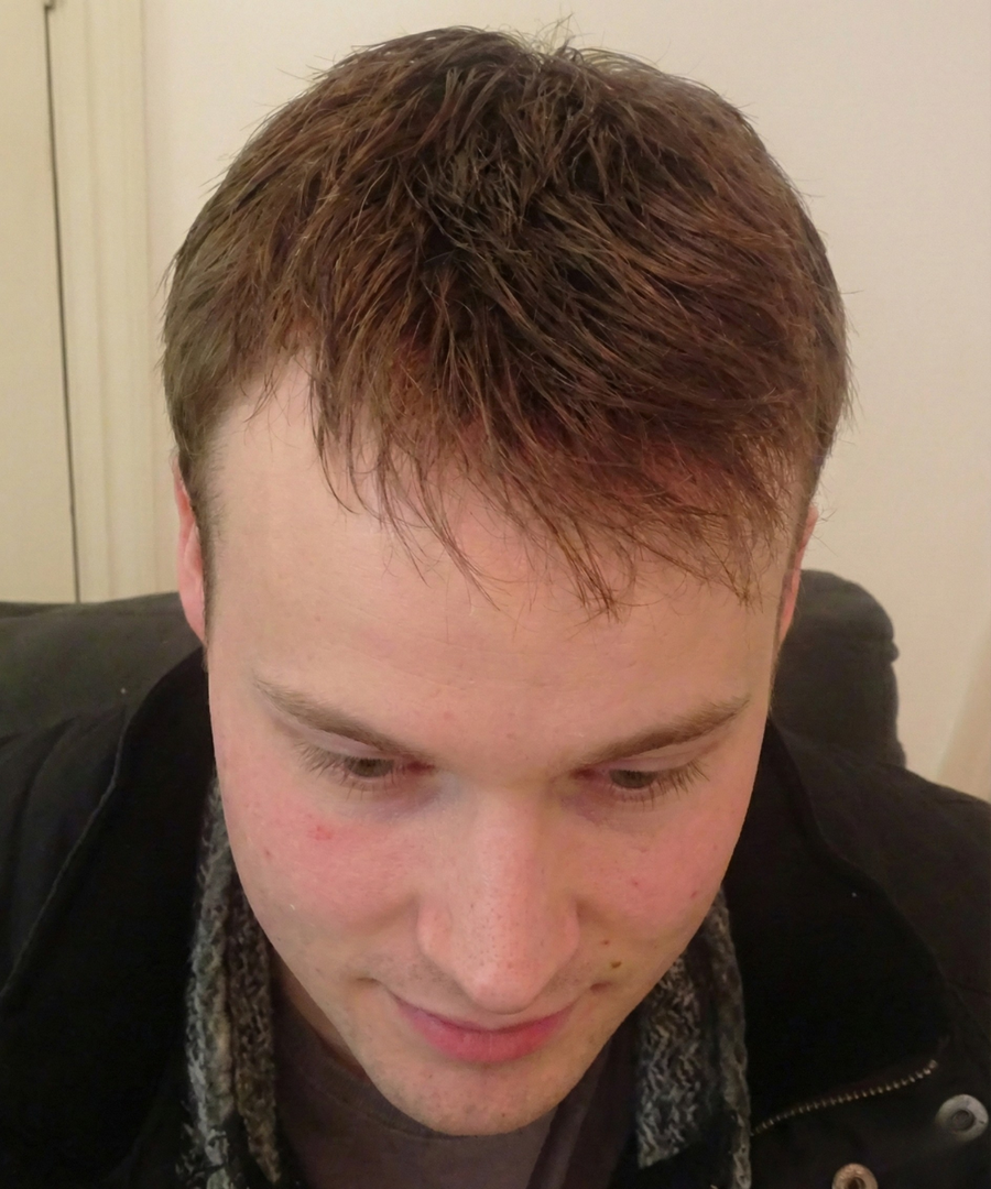 After