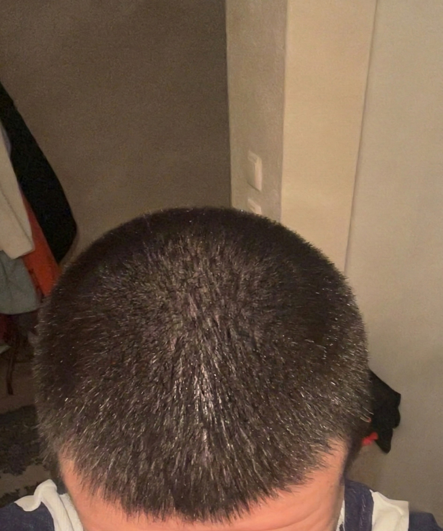 After