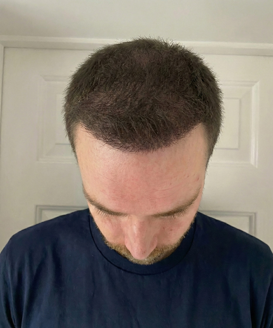 Before