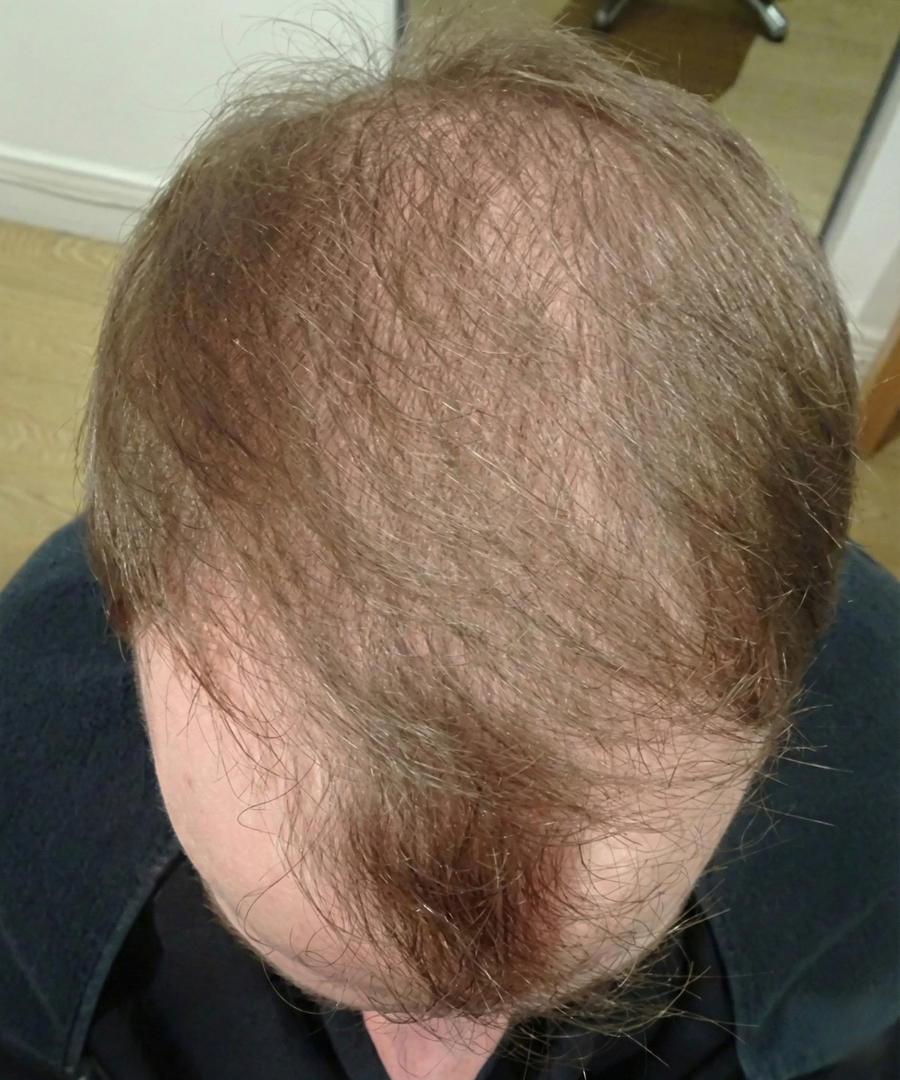 Before