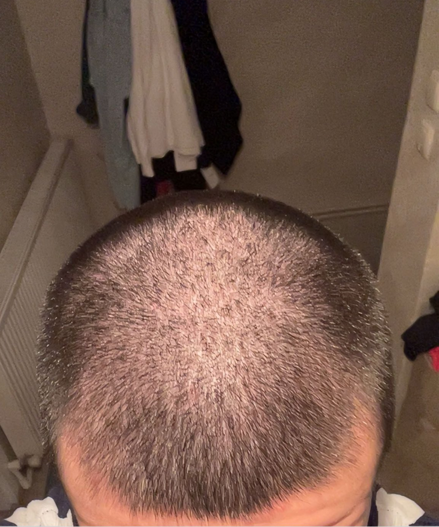 Before